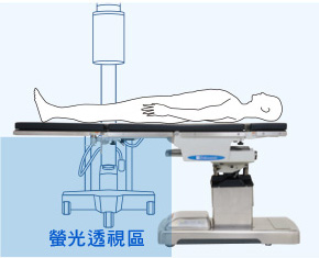 螢光透視用於下肢