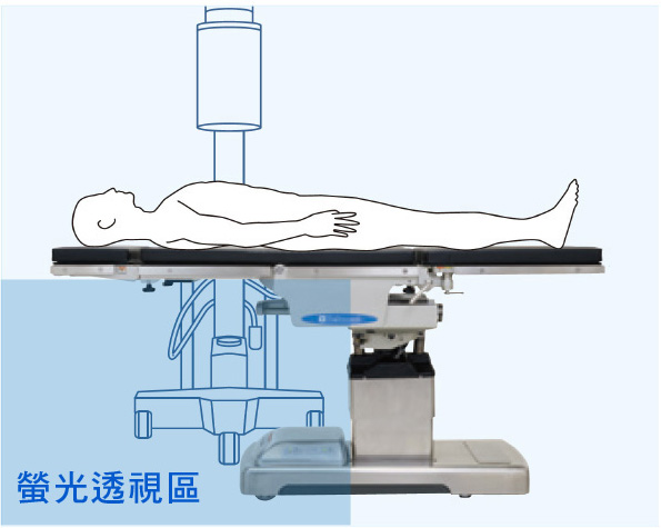 螢光透視用於軀幹