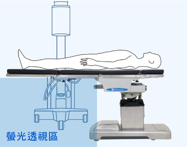 螢光透視用於下肢